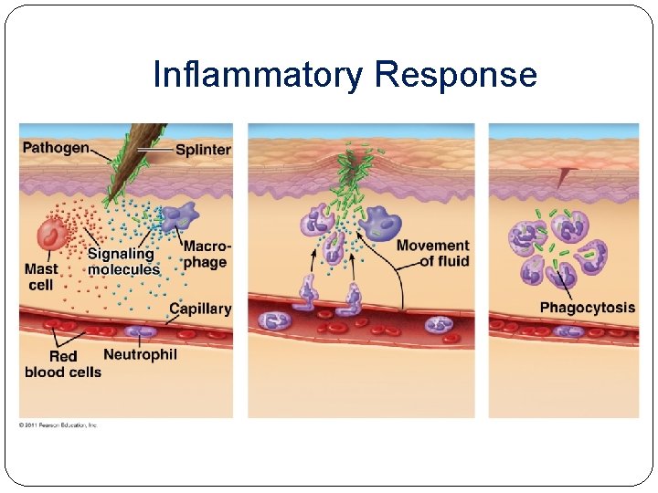 Inflammatory Response 