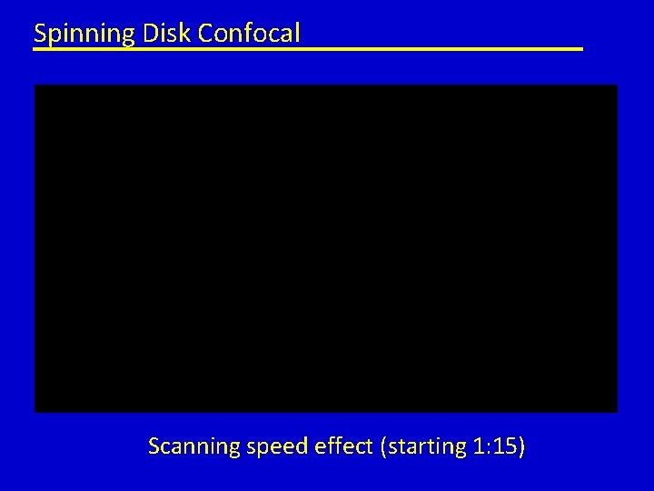 Spinning Disk Confocal Scanning speed effect (starting 1: 15) 