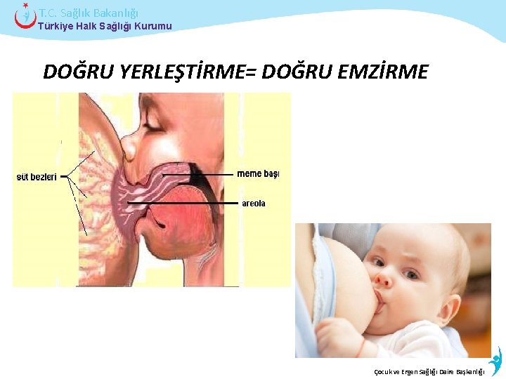 T. C. Sağlık Bakanlığı Türkiye Halk Sağlığı Kurumu DOĞRU YERLEŞTİRME= DOĞRU EMZİRME İstatistik Çocukveve.