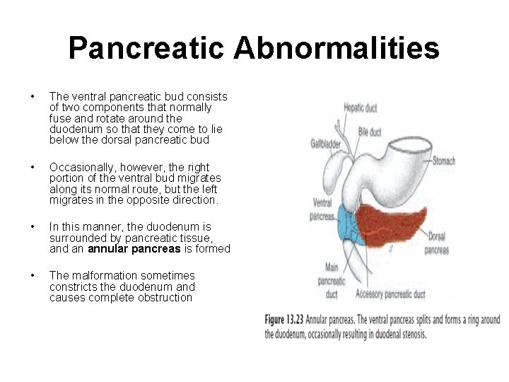 Pancreatic Abnormalities • The ventral pancreatic bud consists of two components that normally fuse