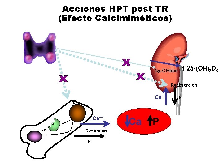 Acciones HPT post TR (Efecto Calcimiméticos) 1 a-OHase 1, 25 -(OH)2 D 3 Reabsorción