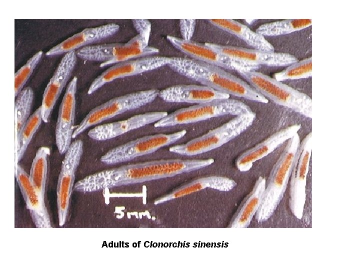 Adults of Clonorchis sinensis 