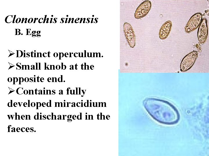 Clonorchis sinensis B. Egg ØDistinct operculum. ØSmall knob at the opposite end. ØContains a