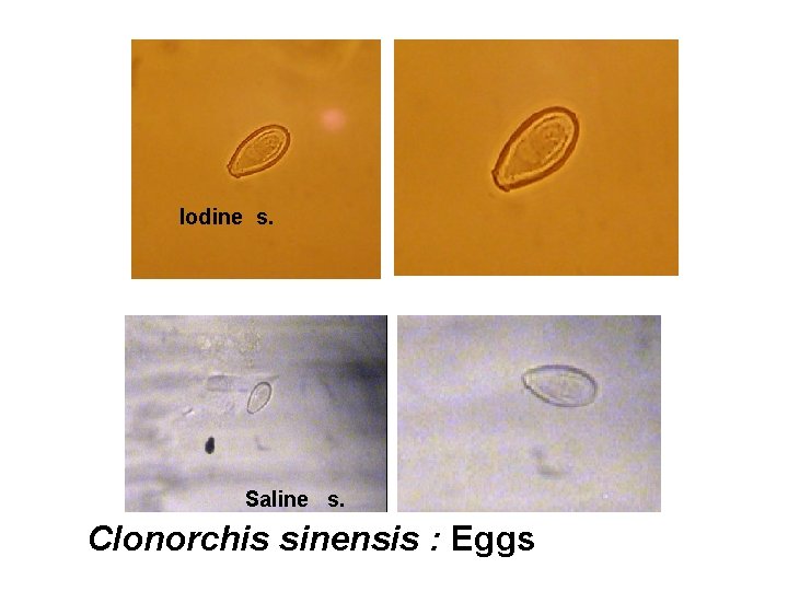 Iodine s. Saline s. Clonorchis sinensis : Eggs 