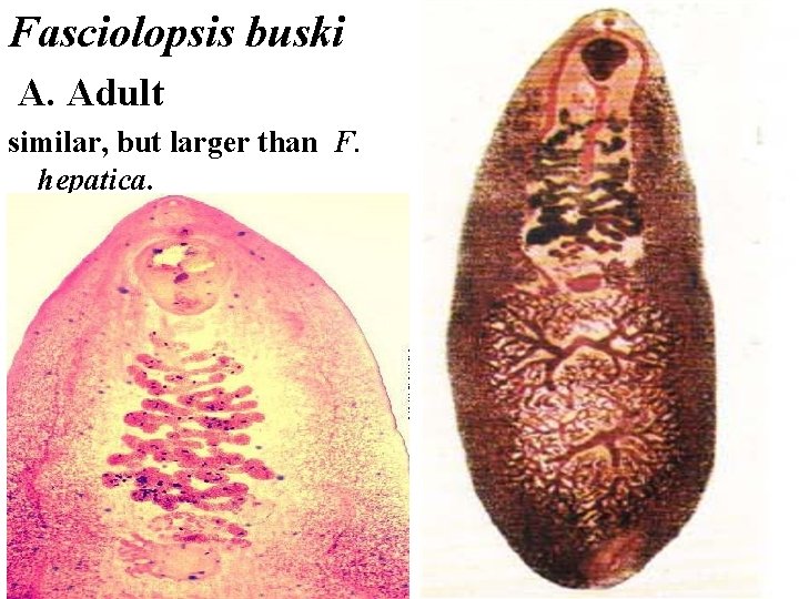 Fasciolopsis buski A. Adult similar, but larger than F. hepatica. 