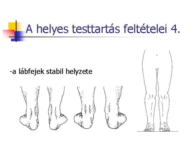 A helyes testtartás feltételei 4. -a lábfejek stabil helyzete 