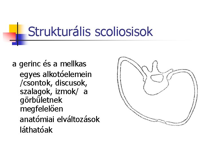 Strukturális scoliosisok a gerinc és a mellkas egyes alkotóelemein /csontok, discusok, szalagok, izmok/ a