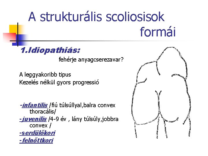 A strukturális scoliosisok formái 1. Idiopathiás: fehérje anyagcserezavar? A leggyakoribb tipus Kezelés nélkül gyors