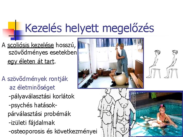 Kezelés helyett megelőzés A scoliósis kezelése hosszú, szövődményes esetekben egy életen át tart. A