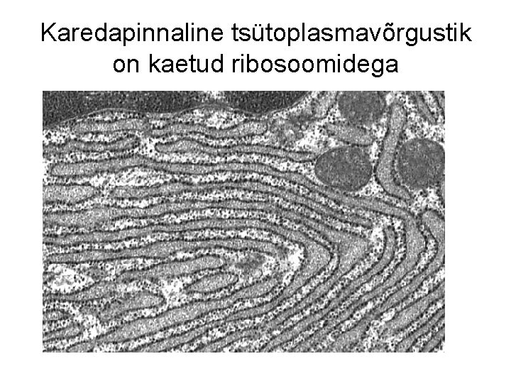 Karedapinnaline tsütoplasmavõrgustik on kaetud ribosoomidega 