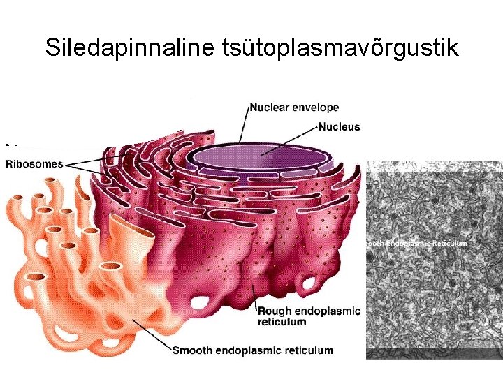 Siledapinnaline tsütoplasmavõrgustik 