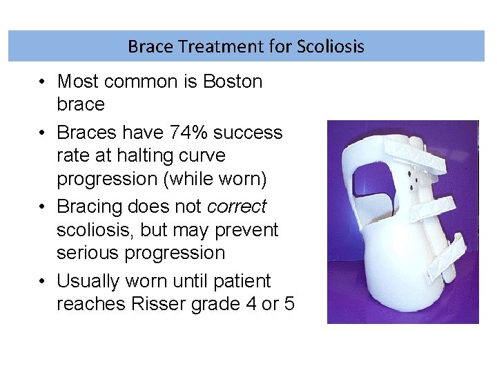 Brace Treatment for Scoliosis • Most common is Boston brace • Braces have 74%