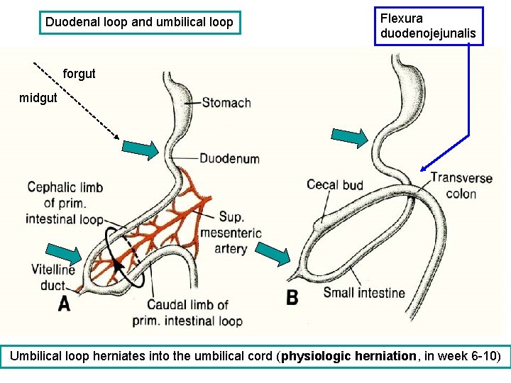 Duodenal loop and umbilical loop Flexura duodenojejunalis forgut midgut Umbilical loop herniates into the