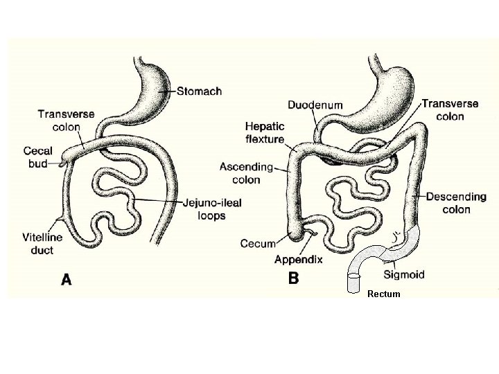 Rectum 