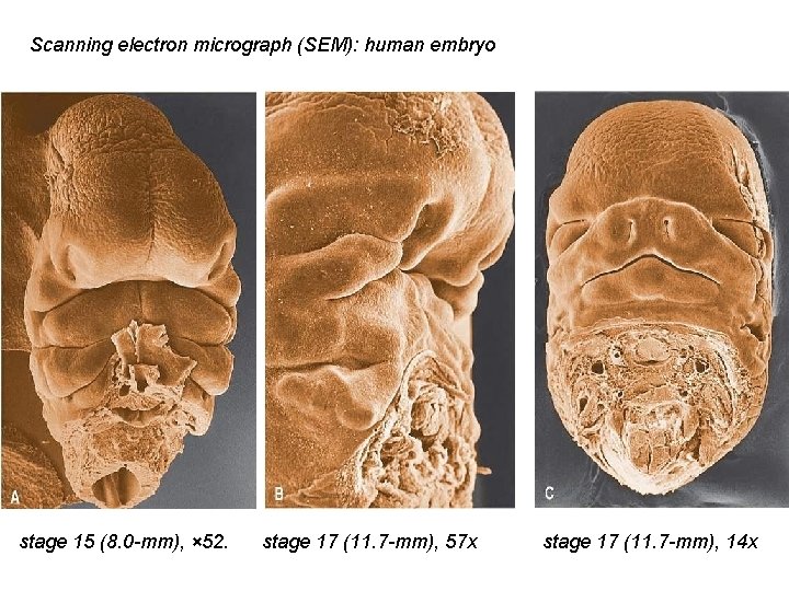 Scanning electron micrograph (SEM): human embryo stage 15 (8. 0 -mm), × 52. stage