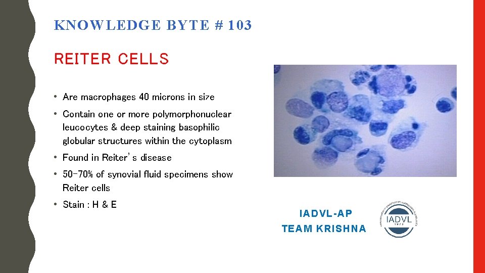 KNOWLEDGE BYTE # 103 REITER CELLS • Are macrophages 40 microns in size •
