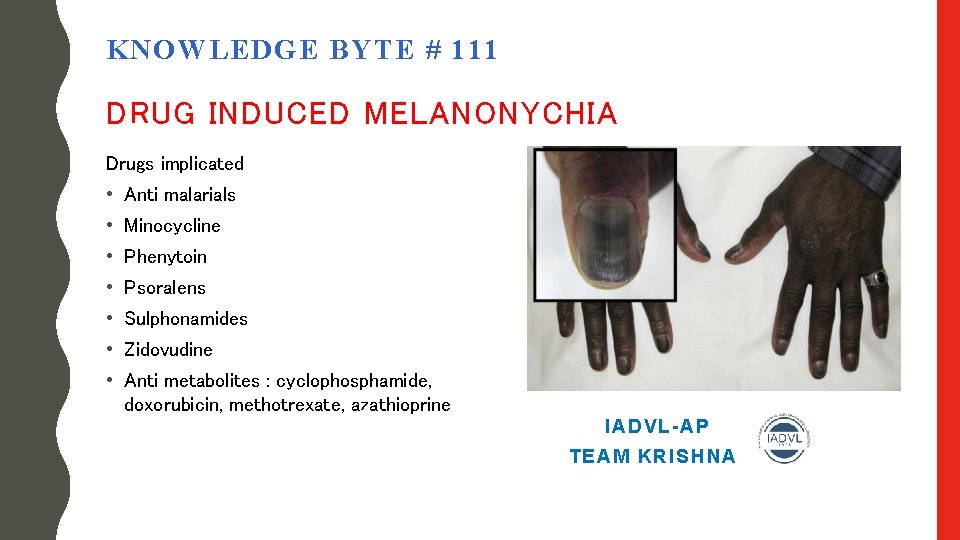 KNOWLEDGE BYTE # 111 DRUG INDUCED MELANONYCHIA Drugs implicated • Anti malarials • Minocycline