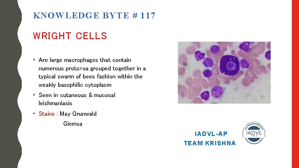 KNOWLEDGE BYTE # 117 WRIGHT CELLS • Are large macrophages that contain numerous protozoa