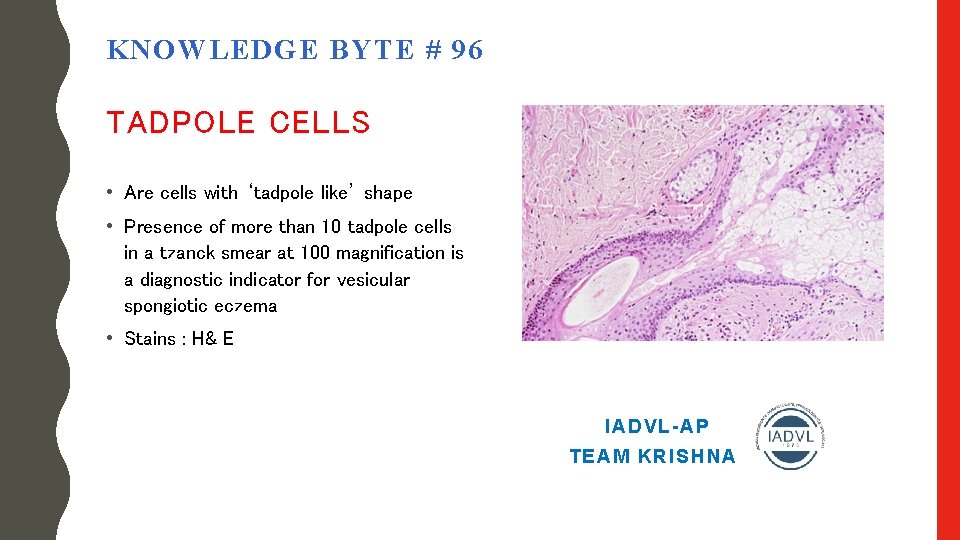 KNOWLEDGE BYTE # 96 TADPOLE CELLS • Are cells with ‘tadpole like’ shape •
