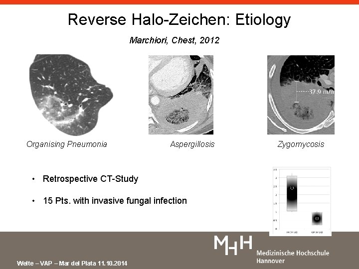 Reverse Halo-Zeichen: Etiology Marchiori, Chest, 2012 Organising Pneumonia Aspergillosis • Retrospective CT-Study • 15