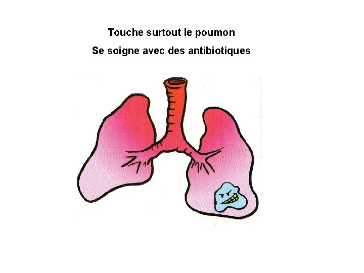 Touche surtout le poumon Se soigne avec des antibiotiques 