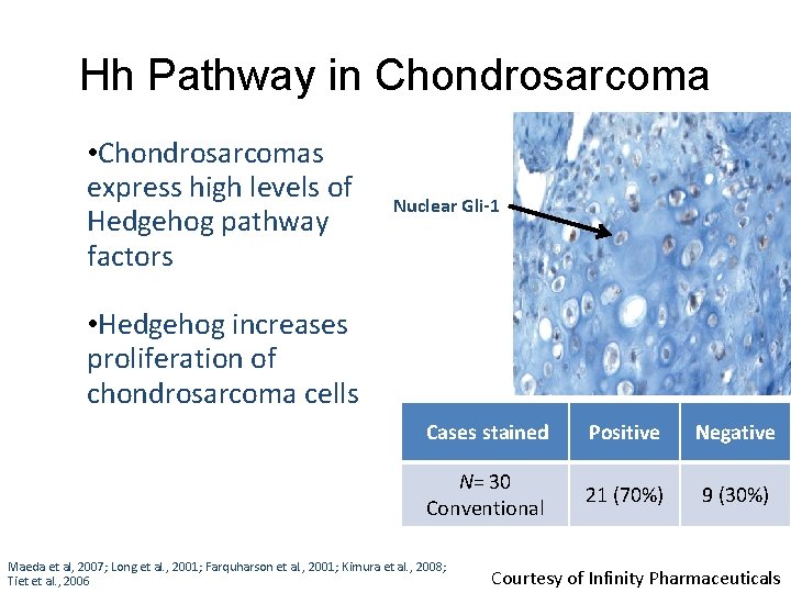 Hh Pathway in Chondrosarcoma • Chondrosarcomas express high levels of Hedgehog pathway factors Nuclear