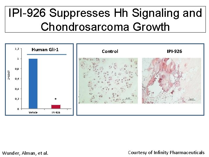 IPI-926 Suppresses Hh Signaling and Chondrosarcoma Growth 1, 2 Human Gli-1 Control IPI-926 2^ΔΔCT