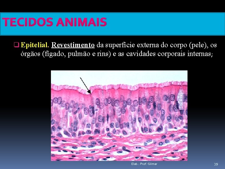 TECIDOS ANIMAIS q Epitelial. Revestimento da superfície externa do corpo (pele), os órgãos (fígado,