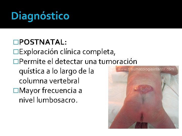 Diagnóstico �POSTNATAL: �Exploración clínica completa, �Permite el detectar una tumoración quística a lo largo