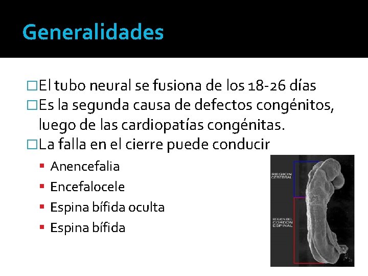 Generalidades �El tubo neural se fusiona de los 18 -26 días �Es la segunda