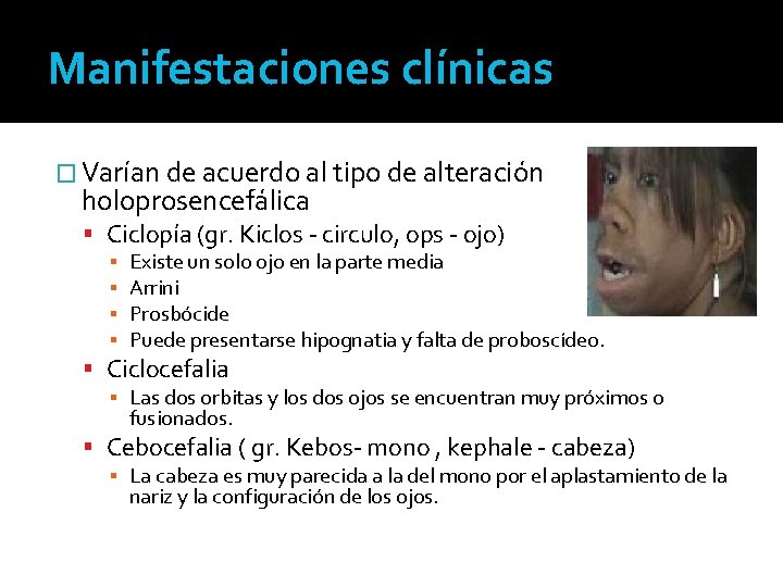 Manifestaciones clínicas � Varían de acuerdo al tipo de alteración holoprosencefálica Ciclopía (gr. Kiclos