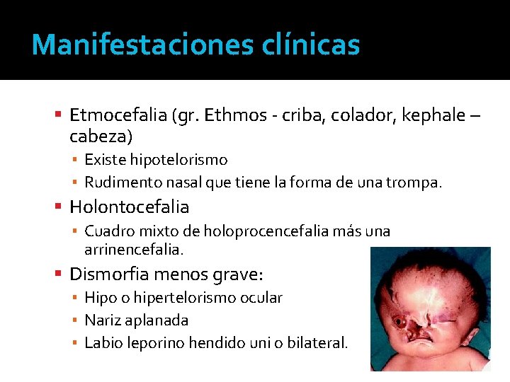 Manifestaciones clínicas Etmocefalia (gr. Ethmos - criba, colador, kephale – cabeza) ▪ Existe hipotelorismo