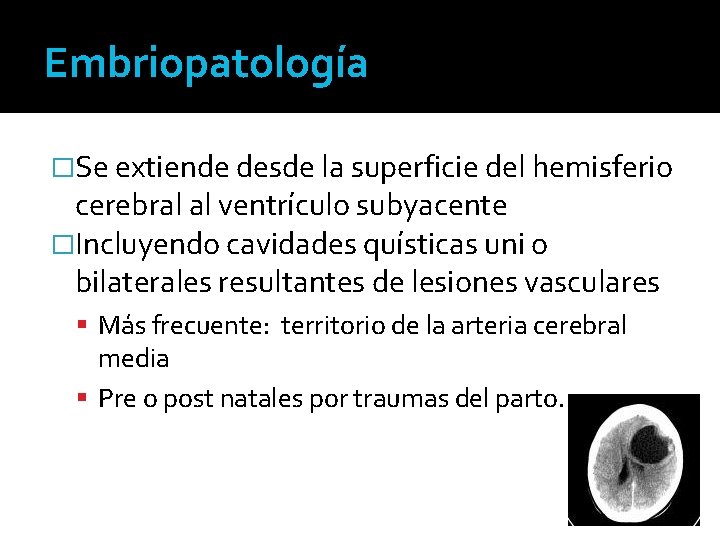 Embriopatología �Se extiende desde la superficie del hemisferio cerebral al ventrículo subyacente �Incluyendo cavidades