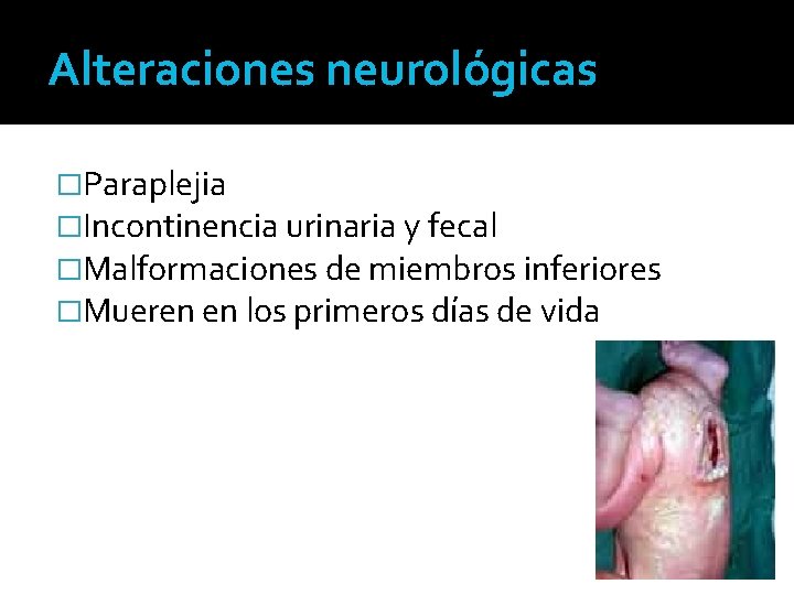 Alteraciones neurológicas �Paraplejia �Incontinencia urinaria y fecal �Malformaciones de miembros inferiores �Mueren en los