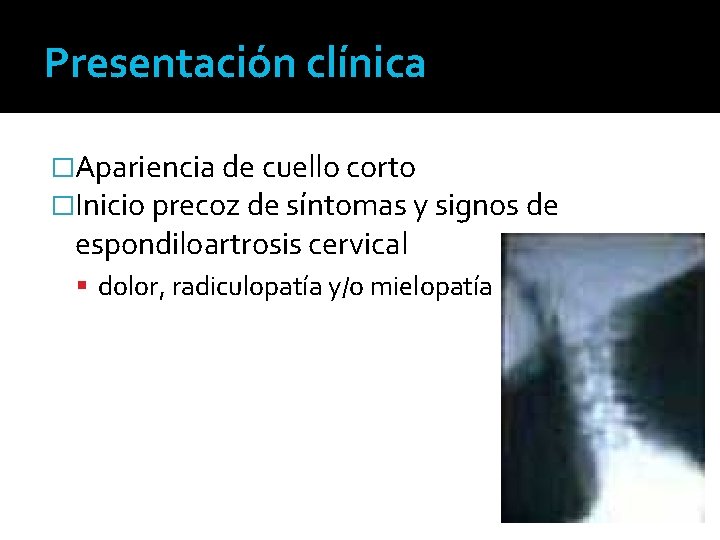 Presentación clínica �Apariencia de cuello corto �Inicio precoz de síntomas y signos de espondiloartrosis