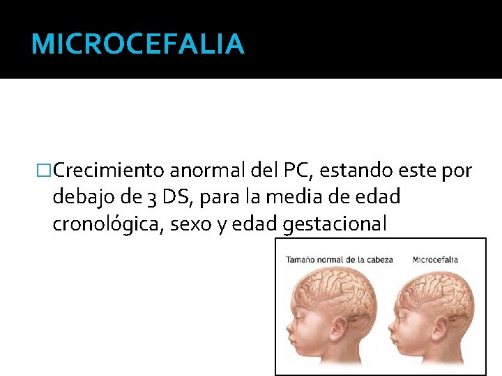 MICROCEFALIA �Crecimiento anormal del PC, estando este por debajo de 3 DS, para la