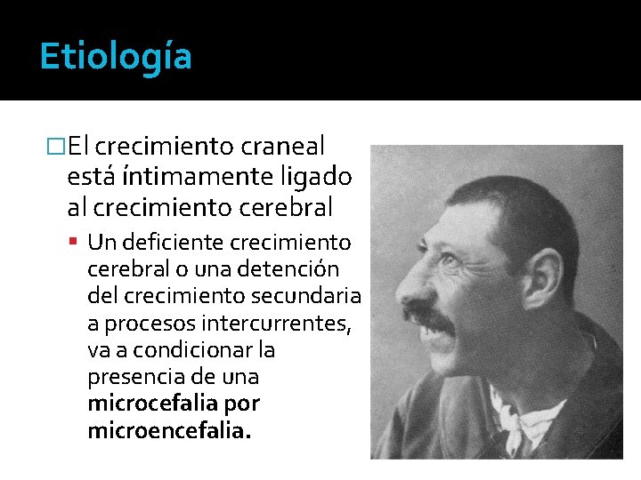 Etiología �El crecimiento craneal está íntimamente ligado al crecimiento cerebral Un deficiente crecimiento cerebral