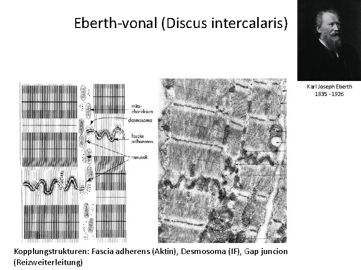 Eberth-vonal (Discus intercalaris) Karl Joseph Eberth 1835 - 1926 Kopplungstrukturen: Fascia adherens (Aktin), Desmosoma