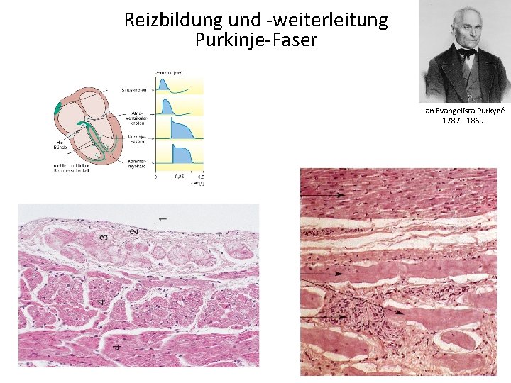 Reizbildung und -weiterleitung Purkinje-Faser Jan Evangelista Purkyně 1787 - 1869 