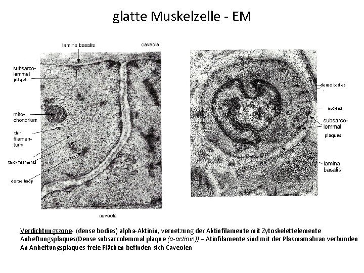 glatte Muskelzelle - EM plaque dense bodies nucleus thin plaques thick filaments dense body