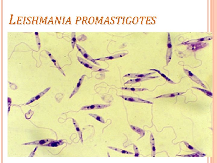 LEISHMANIA PROMASTIGOTES 