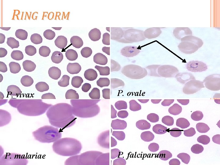 RING FORM P. vivax P. ovale P. malariae P. falciparum 