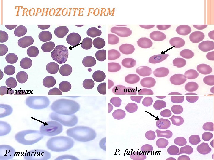 TROPHOZOITE FORM P. vivax P. ovale P. malariae P. falciparum 