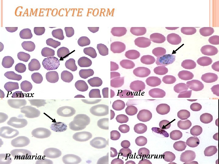 GAMETOCYTE FORM P. vivax P. ovale P. malariae P. falciparum 