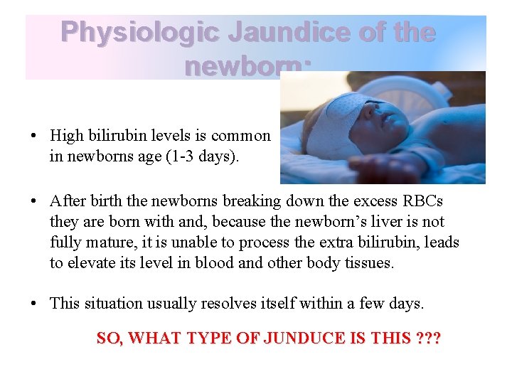 Physiologic Jaundice of the newborn: • High bilirubin levels is common in newborns age