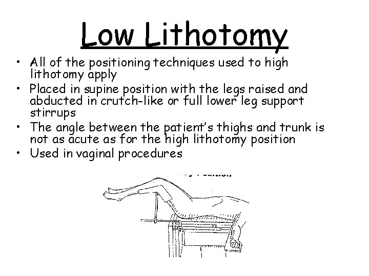 Low Lithotomy • All of the positioning techniques used to high lithotomy apply •