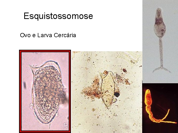 Esquistossomose Ovo e Larva Cercária 