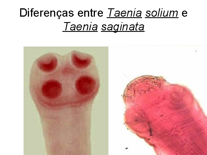 Diferenças entre Taenia solium e Taenia saginata 