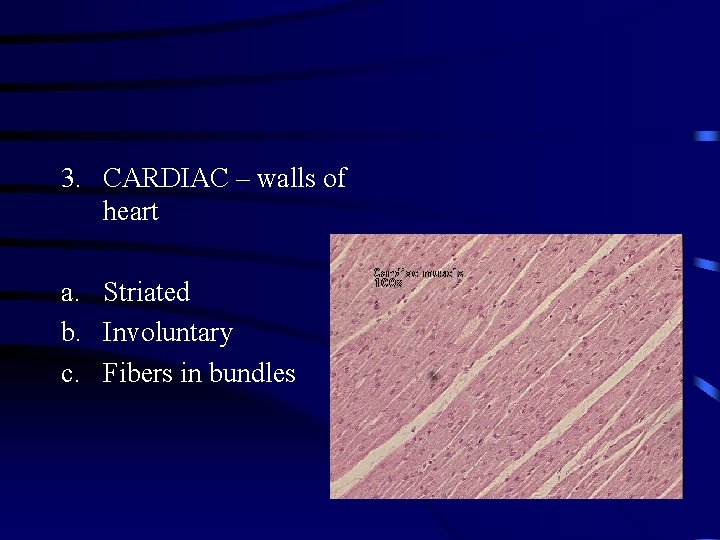 3. CARDIAC – walls of heart a. Striated b. Involuntary c. Fibers in bundles