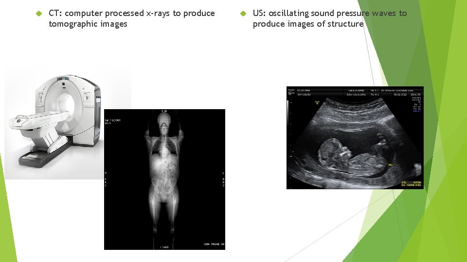  CT: computer processed x-rays to produce tomographic images US: oscillating sound pressure waves